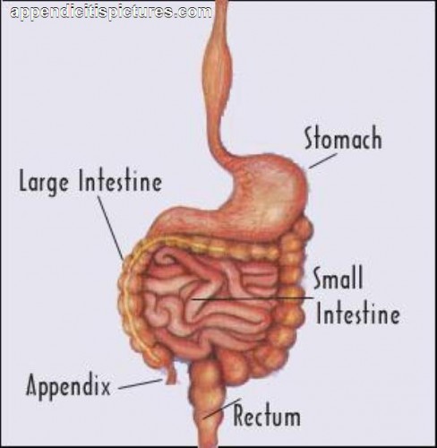 chronic-appendicitis-symptoms-causes-and-treatments