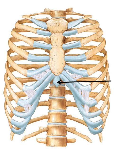 Floating Xiphoid Process at Mary Lakes blog