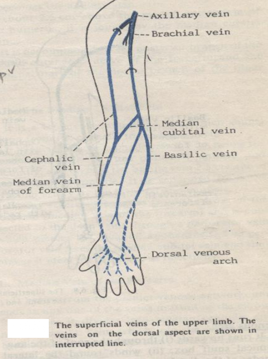 Cephalic Vein Thrombosis