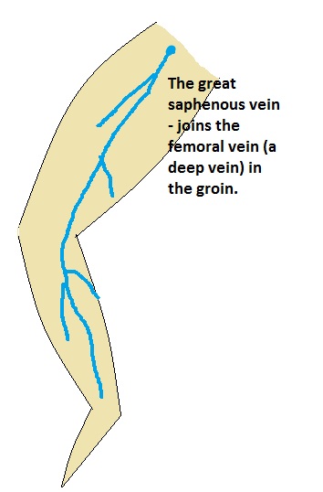 great-saphenous-vein-blood-clot-modernheal