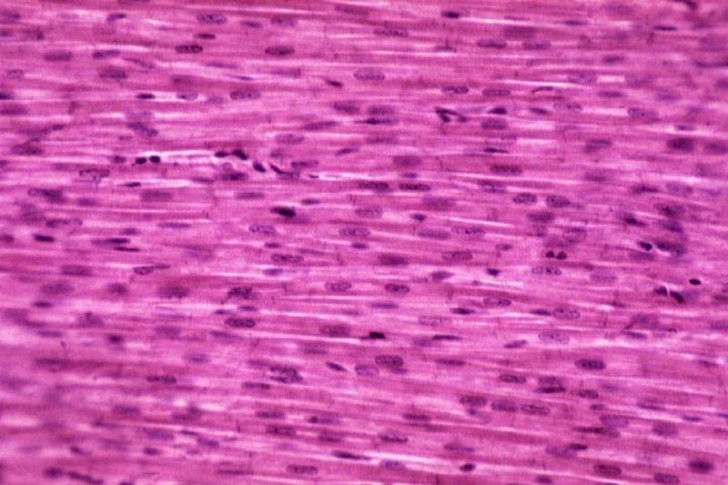 Intercalated Discs In Cardiac Muscle - Modernheal.com